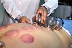 Tiznit: Retrait immédiat des panneaux d&rsquo;affichages de la « hijjama » (Cupping thérapie) à Tiznit.